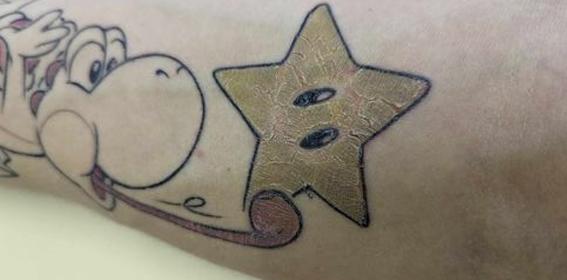 Cicatrisation tatouage couleur tatoueur strasbourg