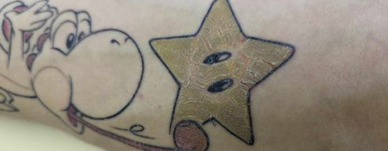 cicatrisation tatouage couleur tattoo tatoueur couleur strasbourg lignes + jaune terne