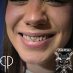 Piercing Smiley Pierceur Strasbourg Bruno Paris Treize